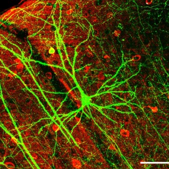 a pyramidal neuron from the hippocampus, stained for green fluorescent protein.